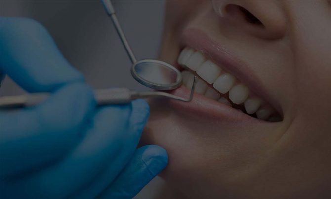 سعر عملية تجميل الأسنان بتونس