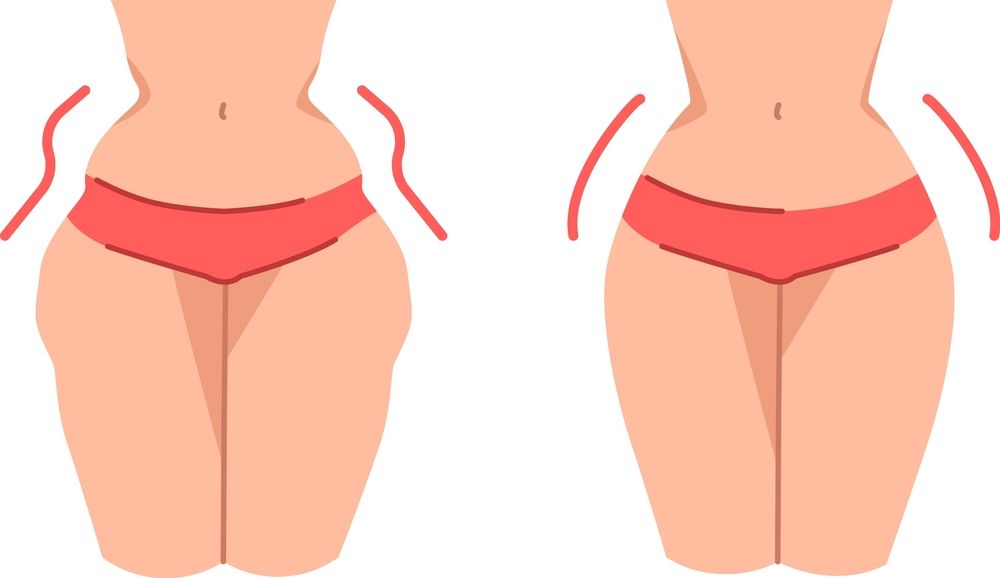 hip dips